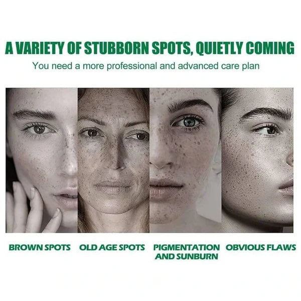 EELHOE™ Dark Spot & Acne Mark Fade Brightening Serum – 50ml